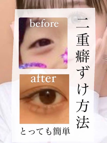 アイビューティー フィクサー ストロングフィルム/アストレア ヴィルゴ/二重まぶた用アイテムを使ったクチコミ(1枚目)