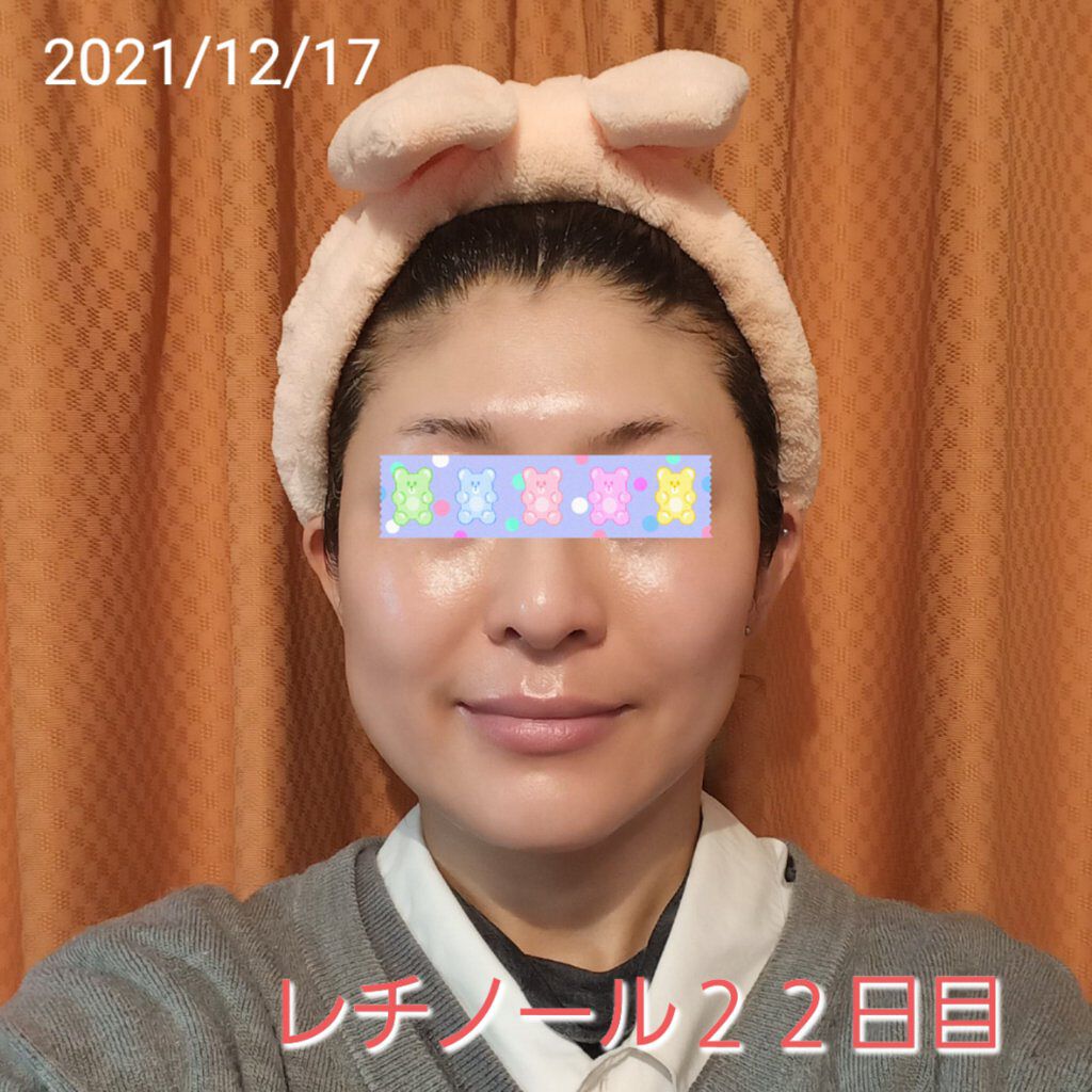 スーパーリンクルセラムVA/KISO/美容液を使ったクチコミ（1枚目）