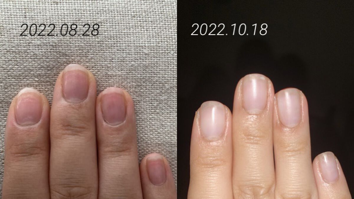 キューティクルオイル/ネイルホリック/ネイルオイル・トリートメントを使ったクチコミ（3枚目）