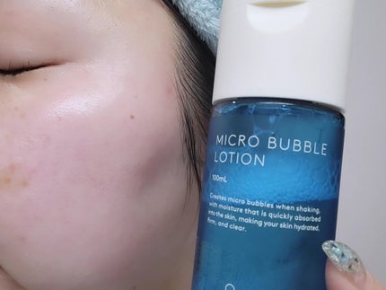 薬用マイクロバブルローション/Macchia Label/化粧水を使ったクチコミ(6枚目)