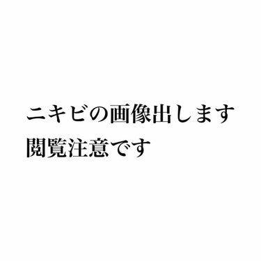 ❄️結晶❄️ on LIPS 「自分の記録用としてと同じ悩みを抱えてる方の少しでもお力になれれ..」（2枚目）