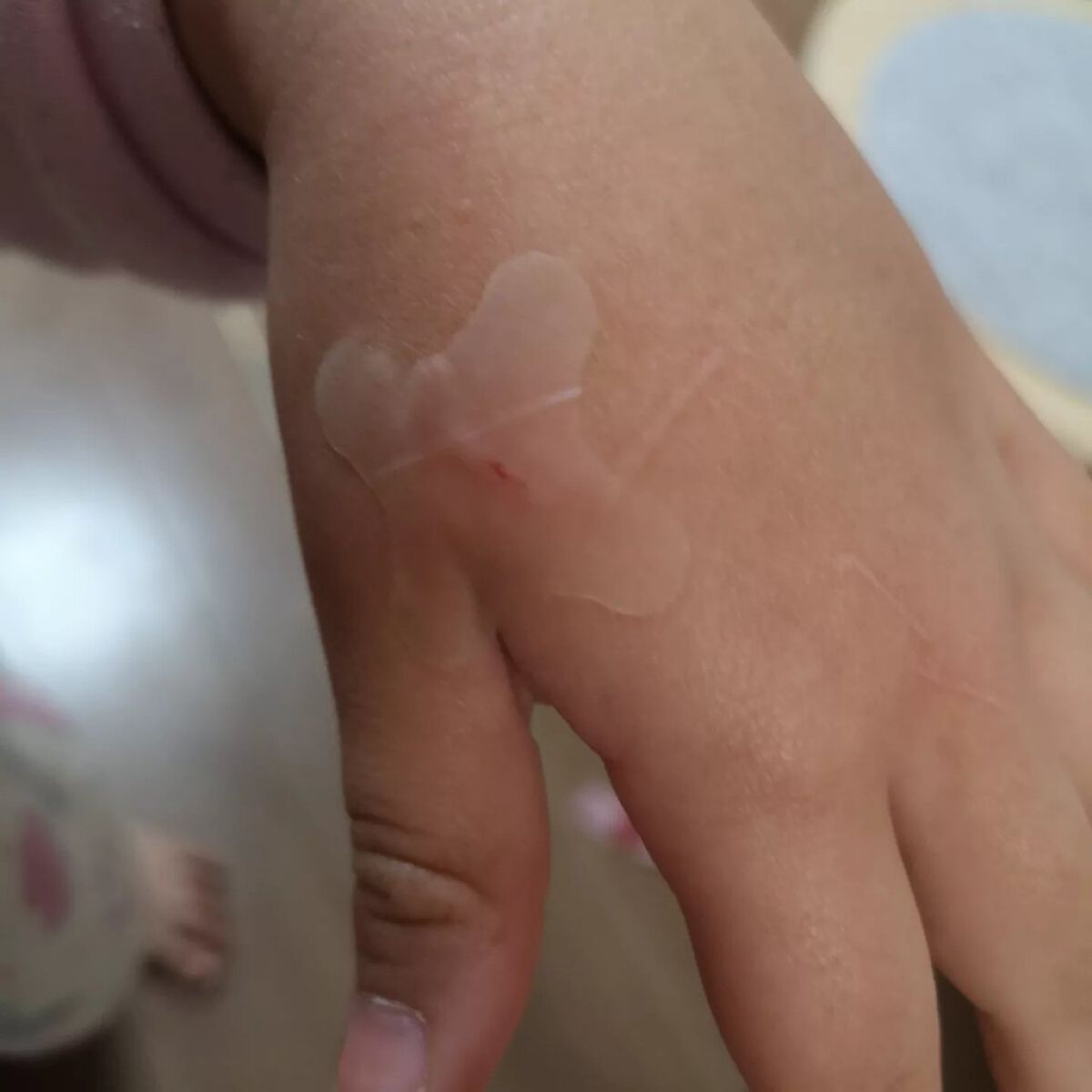 キズクイックfit/東洋化学/その他を使ったクチコミ(5枚目)