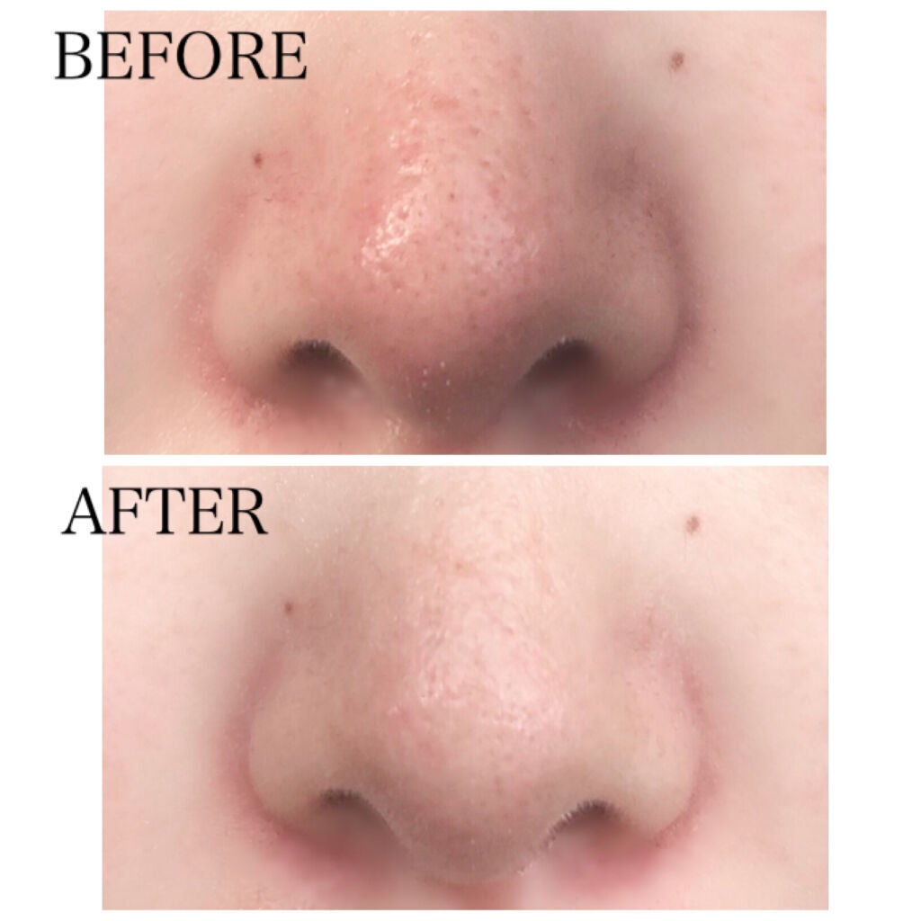 オアシス スージング マスク/Dr.Althea/シートマスク・パックを使ったクチコミ(10枚目)