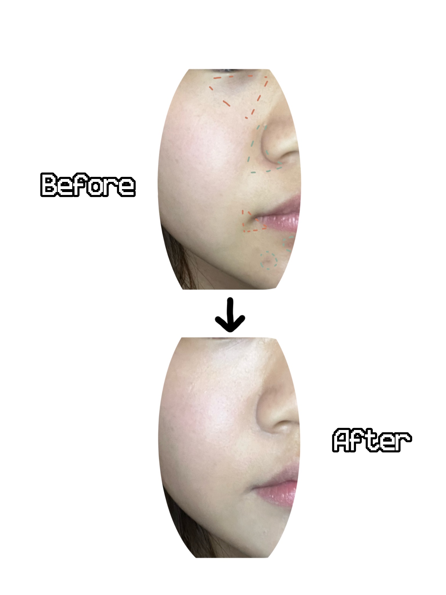 マスクフィット コンシーラーパレット/TIRTIR(ティルティル)/パレットコンシーラーを使ったクチコミ（2枚目）