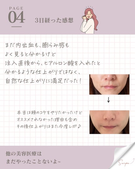 ããð¯æ¯ç©Žã¬ã¹ÃçŸçœéææã远æ±ð on LIPS ããã¢ã«ãã³é
žæ³šå°ðããŒã£ãšè¿·ã£ãŠããŠãéã«ãã£ãŠããŸããå
..ãïŒ5æç®ïŒ