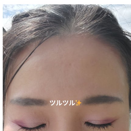 美肌カウンセラー💆肌悩みを解決し見る世界を変える on LIPS 「いま、肌のことで悩んでいても大丈夫!これを見たら絶対に希望がも..」(7枚目)