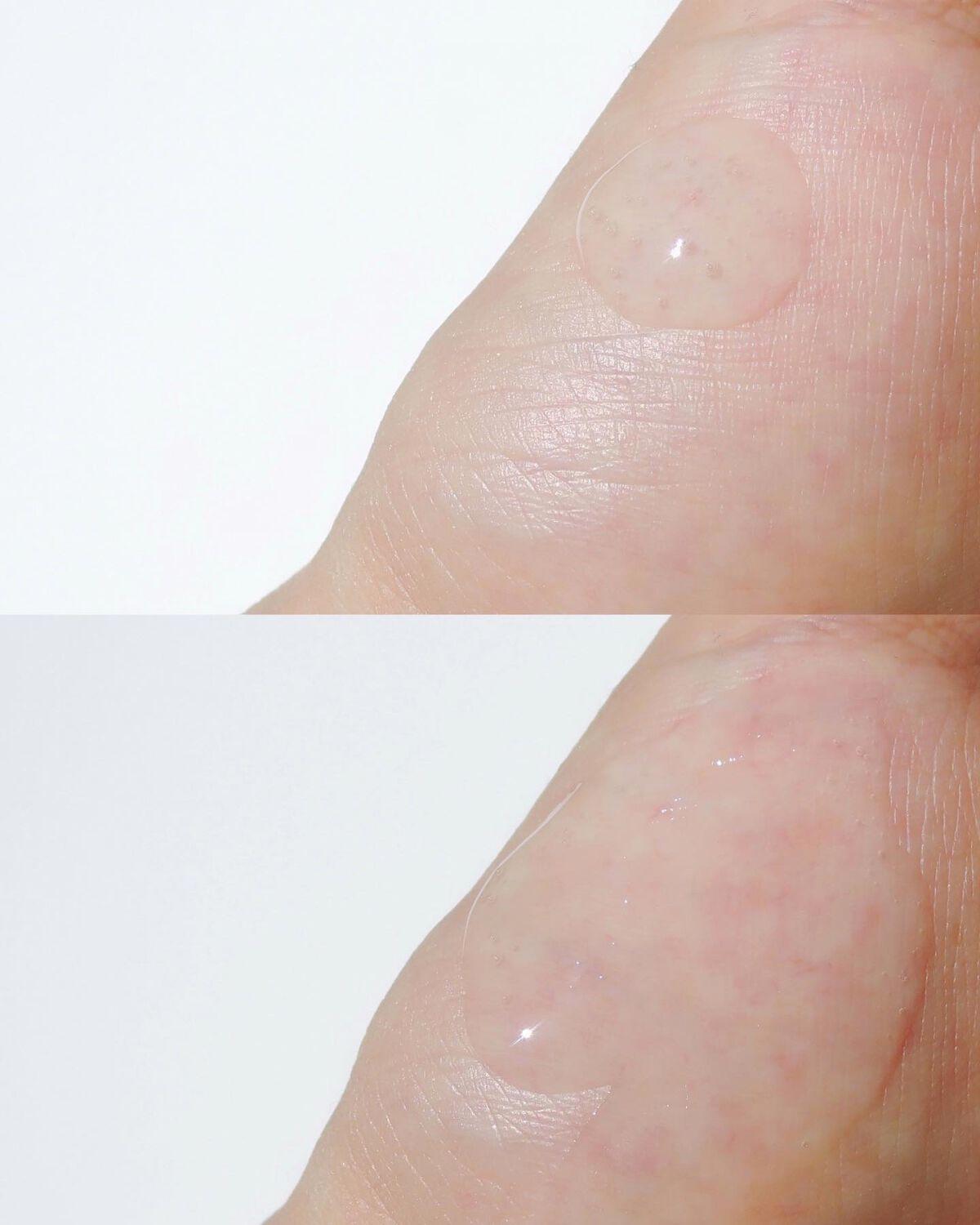 ドクダミカーミングタッチスポットパッド/Abib /トナーパッドを使ったクチコミ(3枚目)