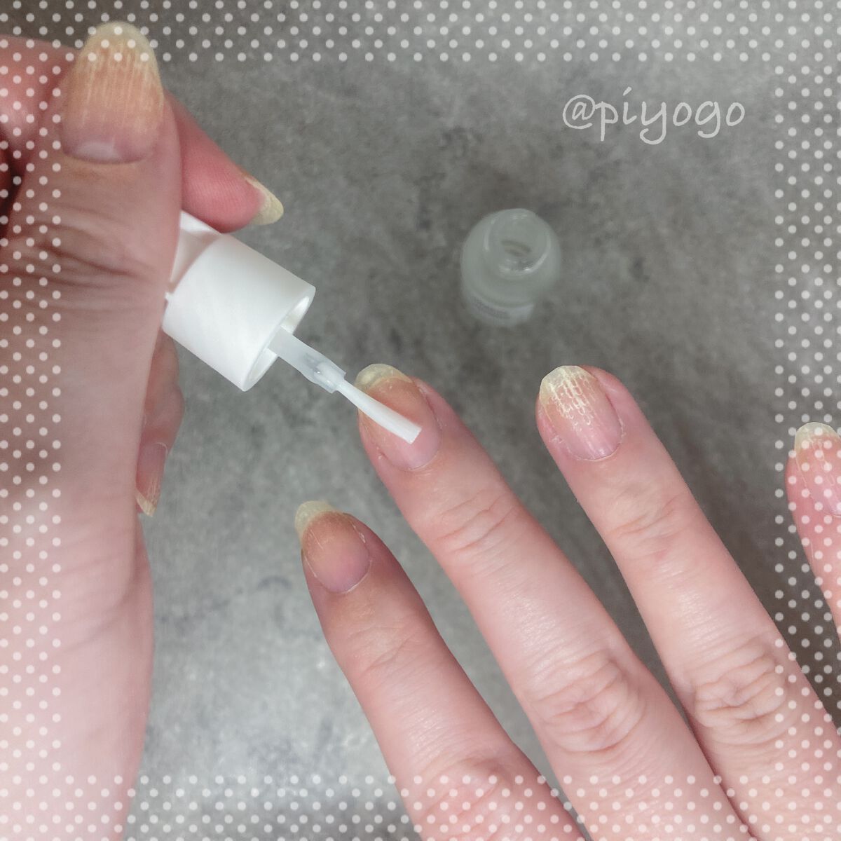 ディープセラム｜Dr.Nailの口コミ「ディープセラム3.3mlをおためししました..」 by ぴよご(混合肌) | LIPS