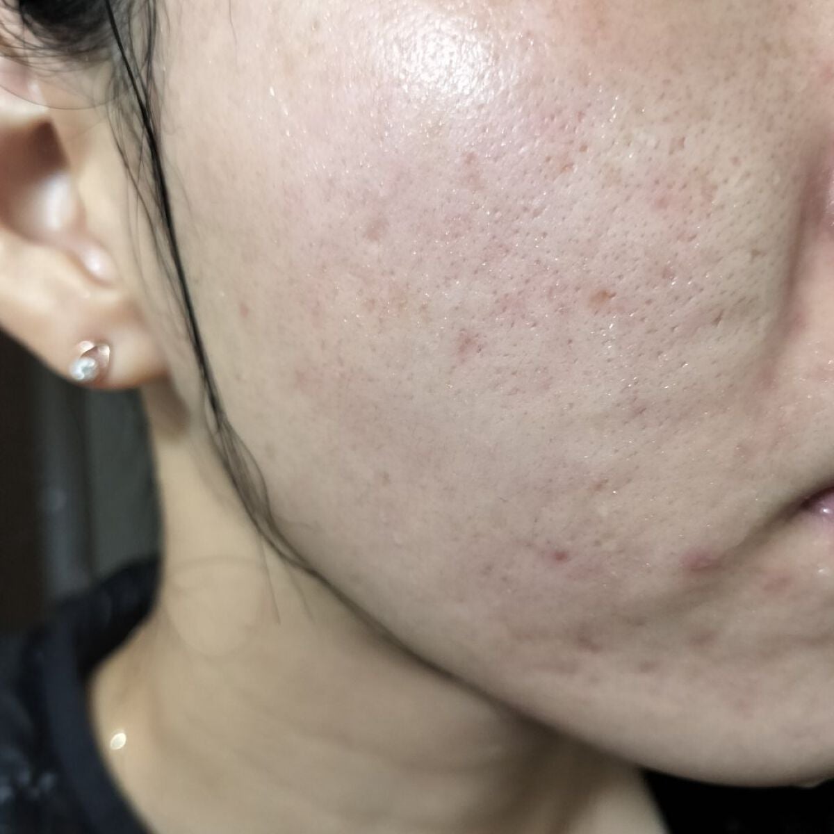 miina@汚肌工事録⚠️ on LIPS 「✍11/14の#汚肌工事録いつもありがとーう🥰🫶/たしか帰って..」(1枚目)