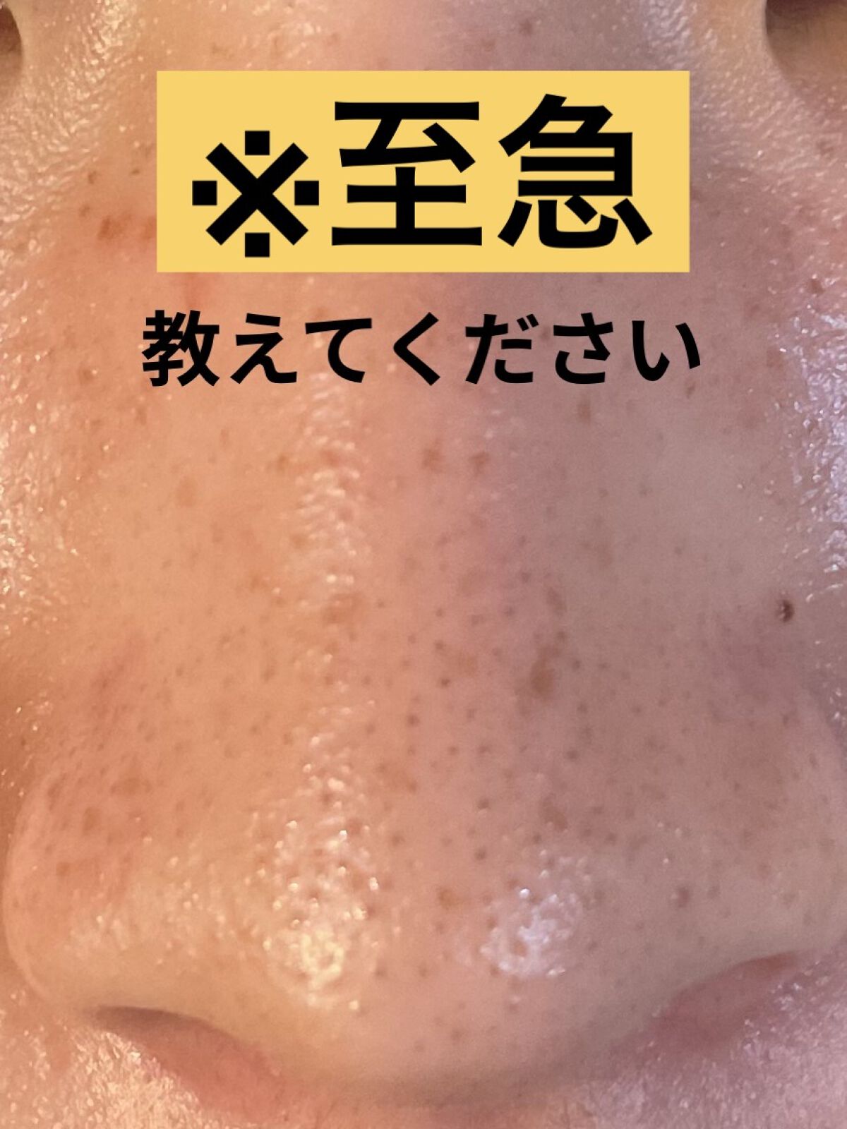 デュオ ザ クレンジングバーム クリア/DUO/クレンジングバームを使ったクチコミ（1枚目）