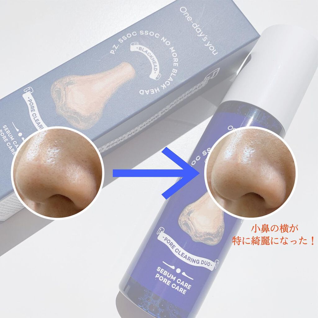 ノーモアブラックヘッド(ノーズピーリング)/One-day's you/スクラブ・ゴマージュを使ったクチコミ(5枚目)