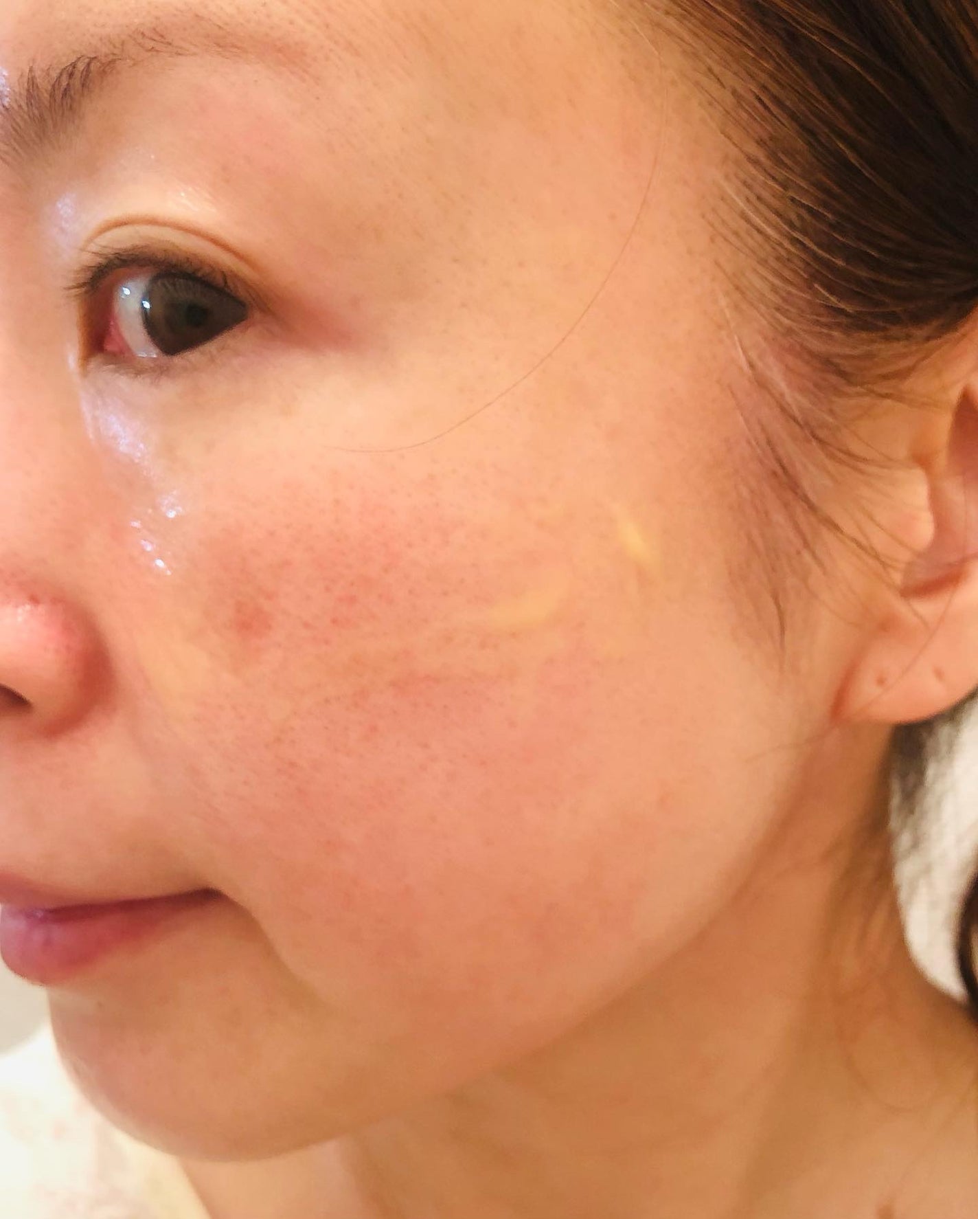 pinkumiria on LIPS 「rovectinロべクチンのレチノシンディープインテンスセラム..」(6枚目)