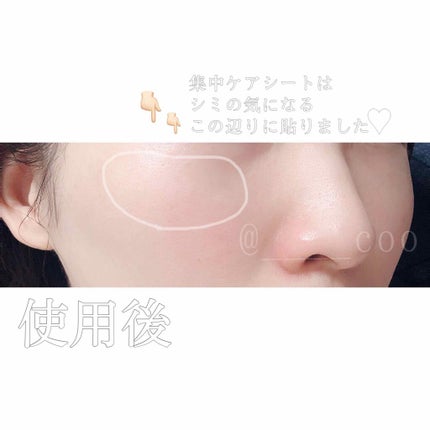 ホワイト ステムブライトショットマスク/リッツ/シートマスク・パックを使ったクチコミ(3枚目)