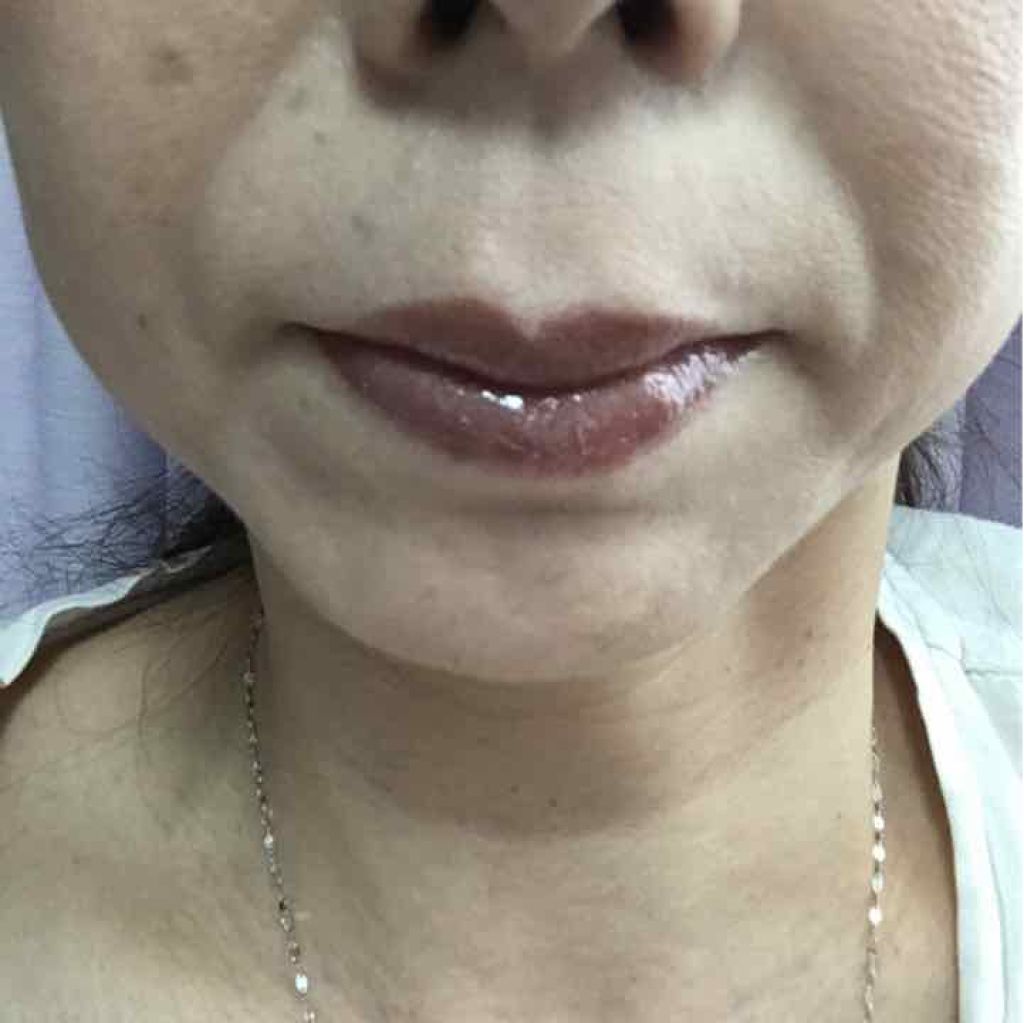 オンブル プルミエール トップコート/CHANEL/単色アイシャドウを使ったクチコミ（3枚目）