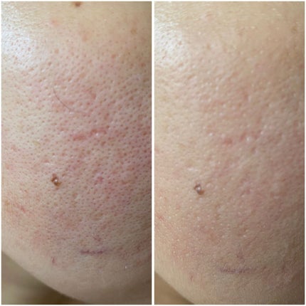 カラーグローファンデーション/sirocos/クリーム・エマルジョンファンデーションを使ったクチコミ(8枚目)