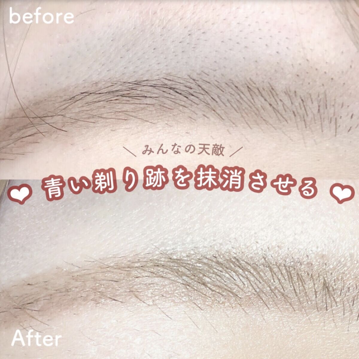 カバーパーフェクション チップコンシーラー/the SAEM/リキッドコンシーラーを使ったクチコミ（1枚目）