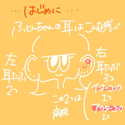 ピアッサー/ピナック/その他を使ったクチコミ(2枚目)