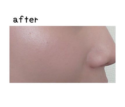 クリームファンデーション/media/クリーム・エマルジョンファンデーションを使ったクチコミ(4枚目)