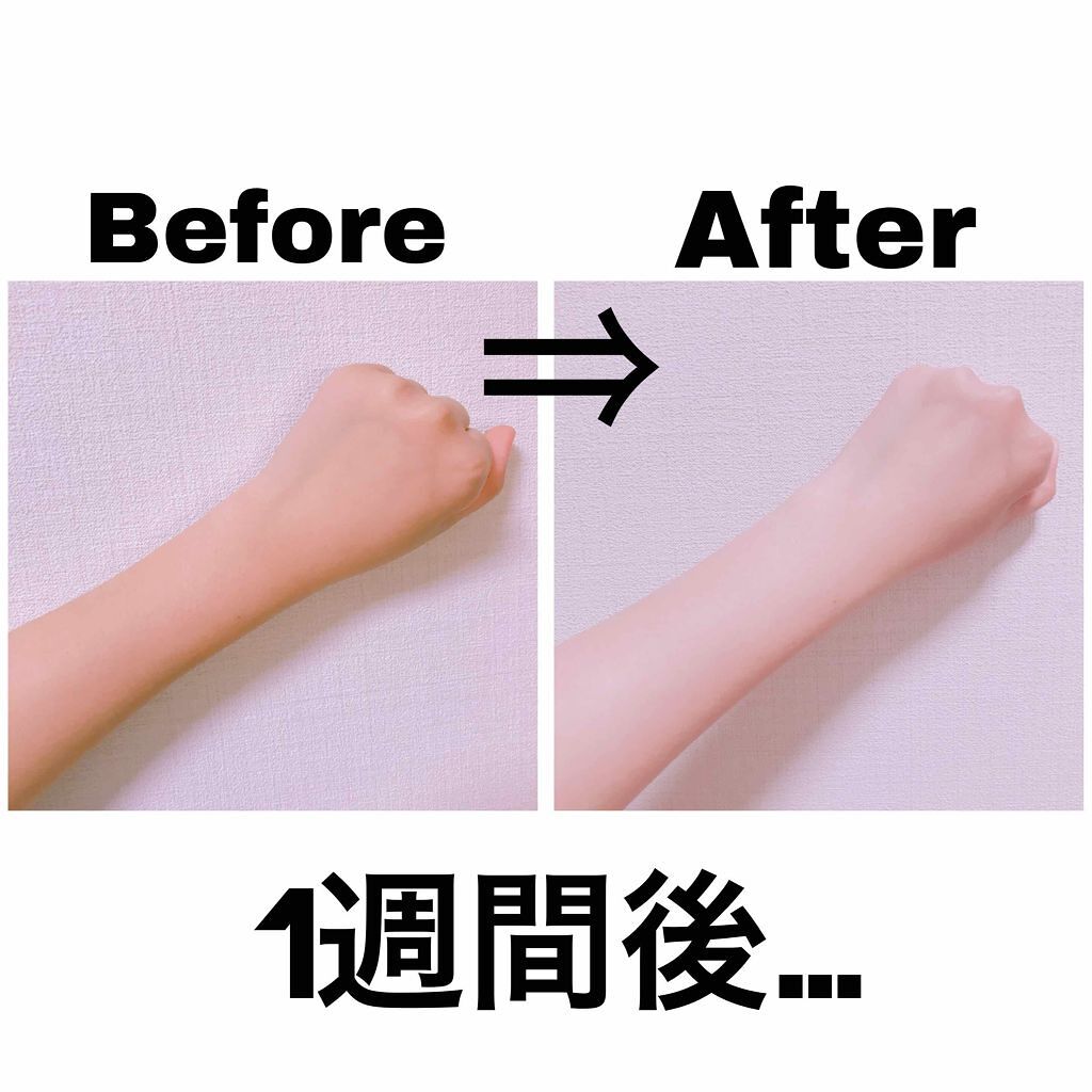 薬用美白 美容液/DAISO/美容液を使ったクチコミ(2枚目)