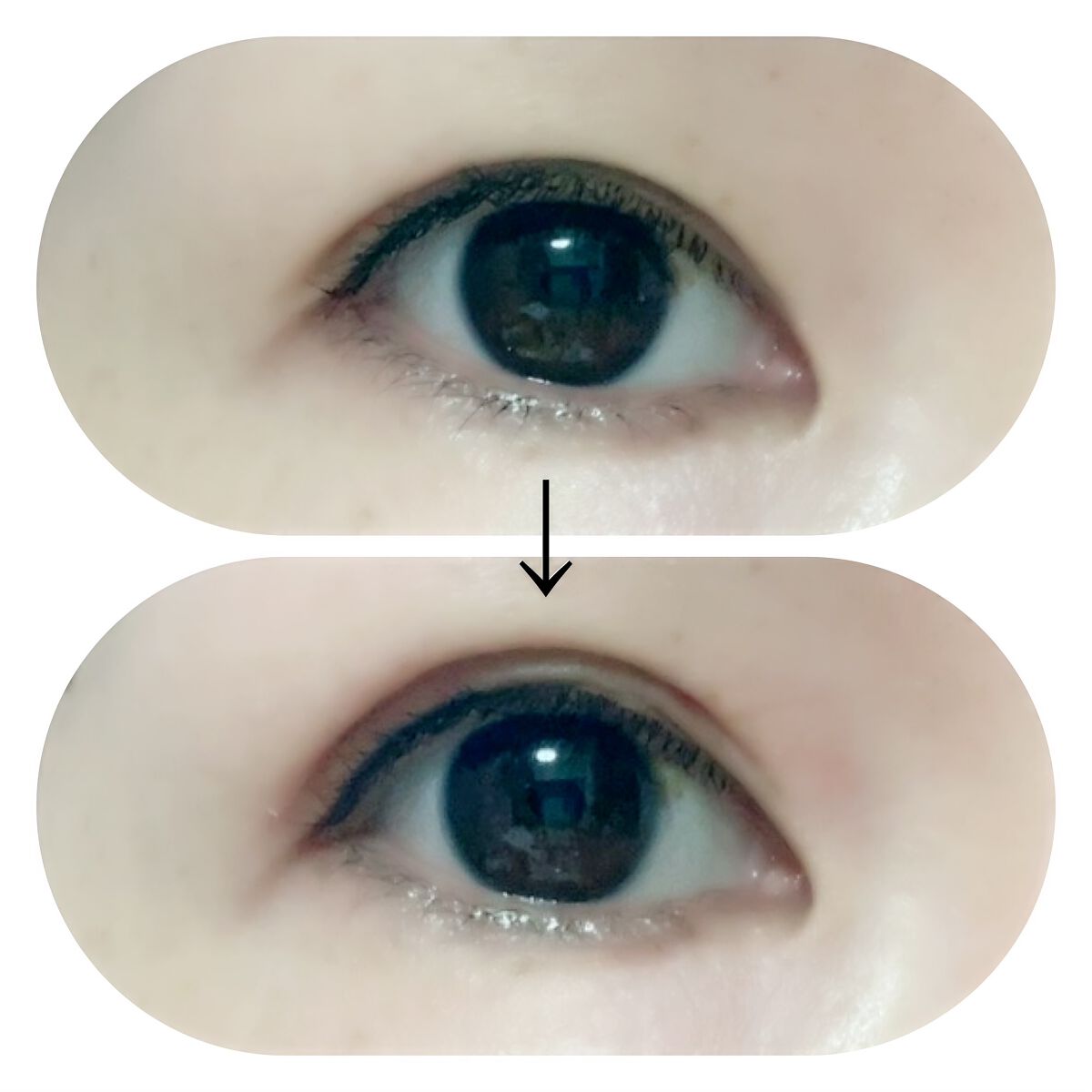 マイクロファイバー /ビー・エヌ/二重まぶた用アイテムを使ったクチコミ(3枚目)