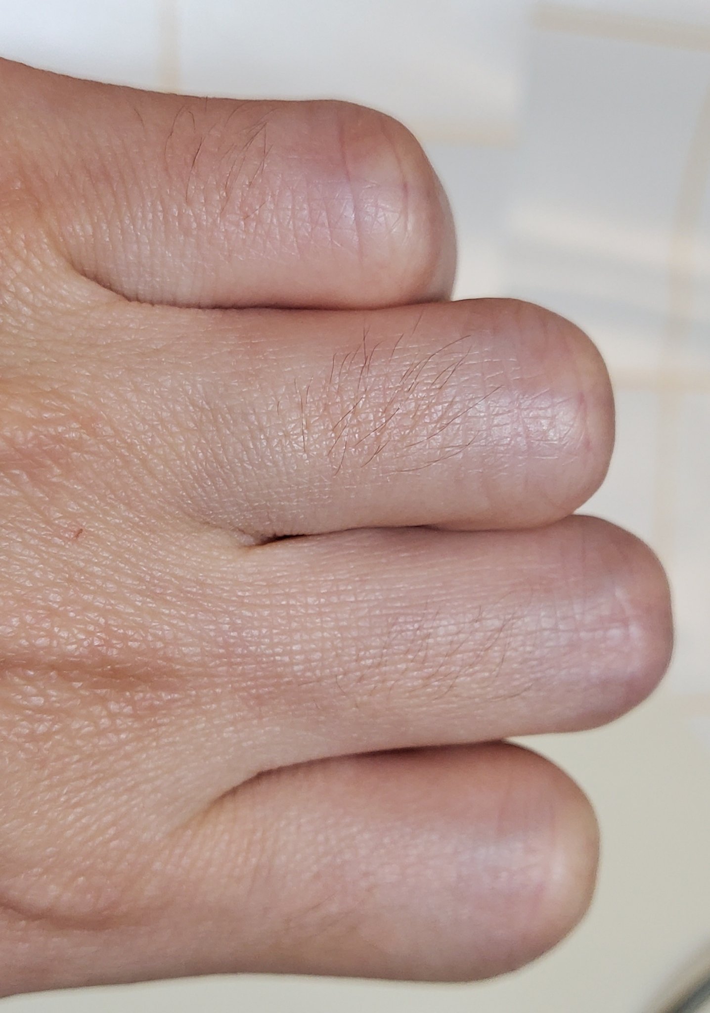 SIPL-1000C 家庭用光美容器/eosika/家庭用脱毛器を使ったクチコミ（2枚目）