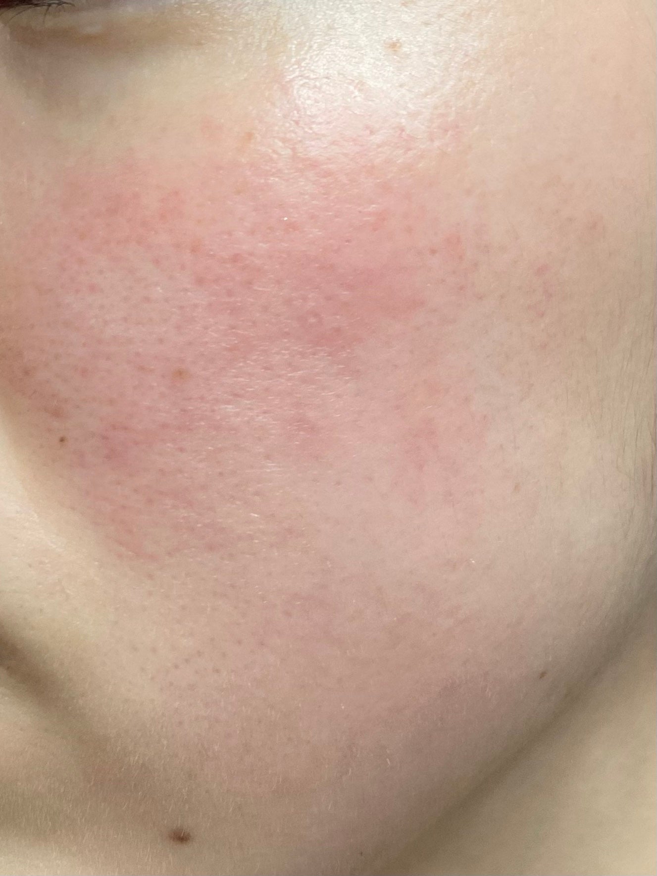 N10+Z1フェイスセラム /The Ordinary/美容液を使ったクチコミ(3枚目)