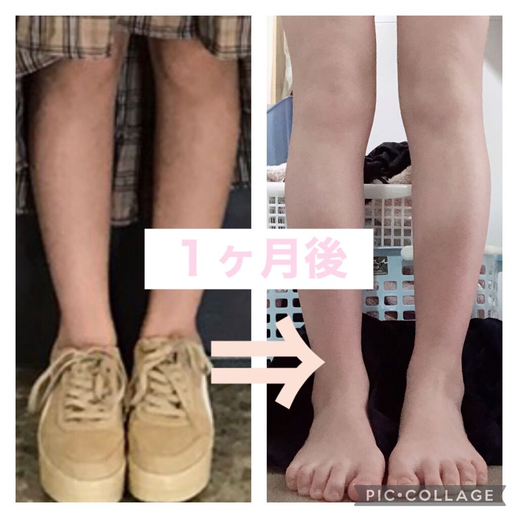 おやすみ着圧ソックス ドン キホーテを使った口コミ 私が足やせ 足を白くした方法 まず By パンダ 普通肌 10代前半 Lips