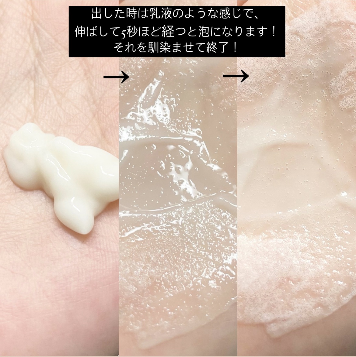 ペプチド ボリューム リフティングプロエッセンス/DR.PEPTI/美容液を使ったクチコミ（3枚目）