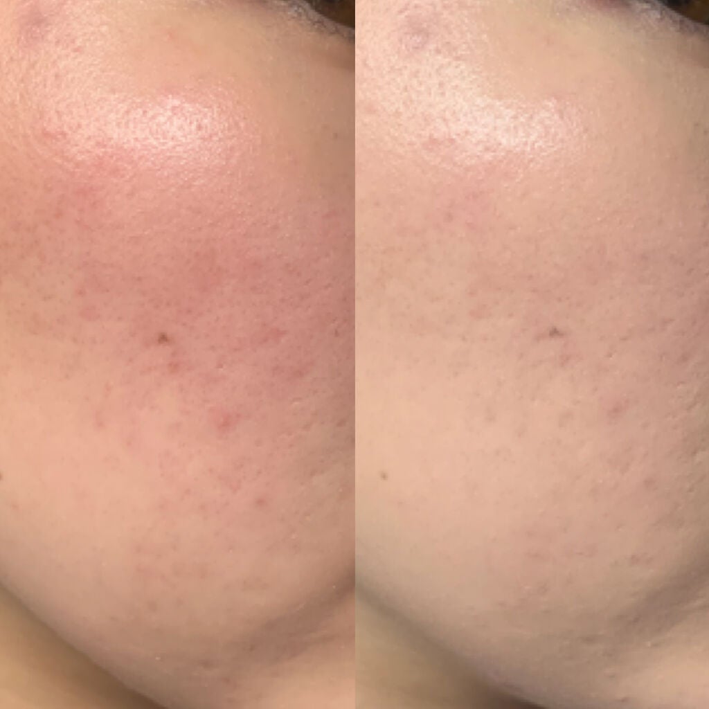 ディオールスキン フォーエヴァー グロウ クッション/Dior/クッションファンデーションを使ったクチコミ(3枚目)