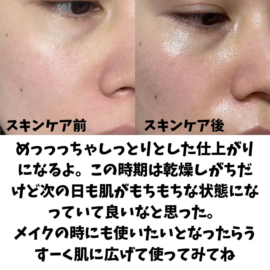 レッドブレミッシュ クリアモイスチャークリーム/Dr.G/フェイスクリームを使ったクチコミ(4枚目)