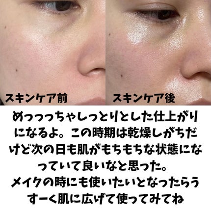 レッドブレミッシュ クリアモイスチャークリーム/Dr.G/フェイスクリームを使ったクチコミ(4枚目)