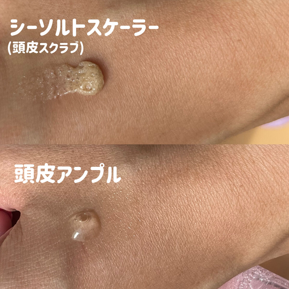 頭皮アンプル/GROWUS/頭皮ローションを使ったクチコミ（3枚目）