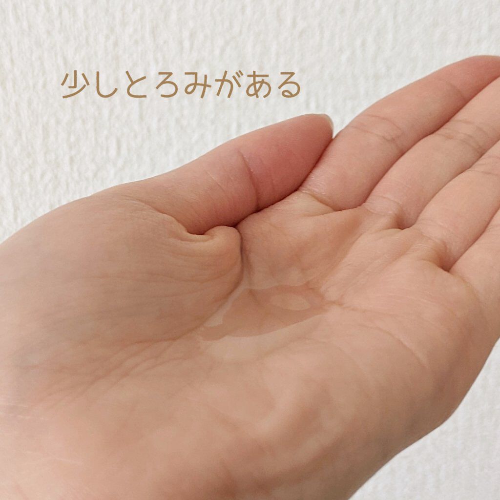 モイストケア ローション MB/d プログラム/化粧水を使ったクチコミ（2枚目）