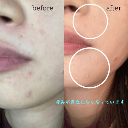 カバーアッププロコンシーラー/TFIT/パレットコンシーラーを使ったクチコミ(4枚目)