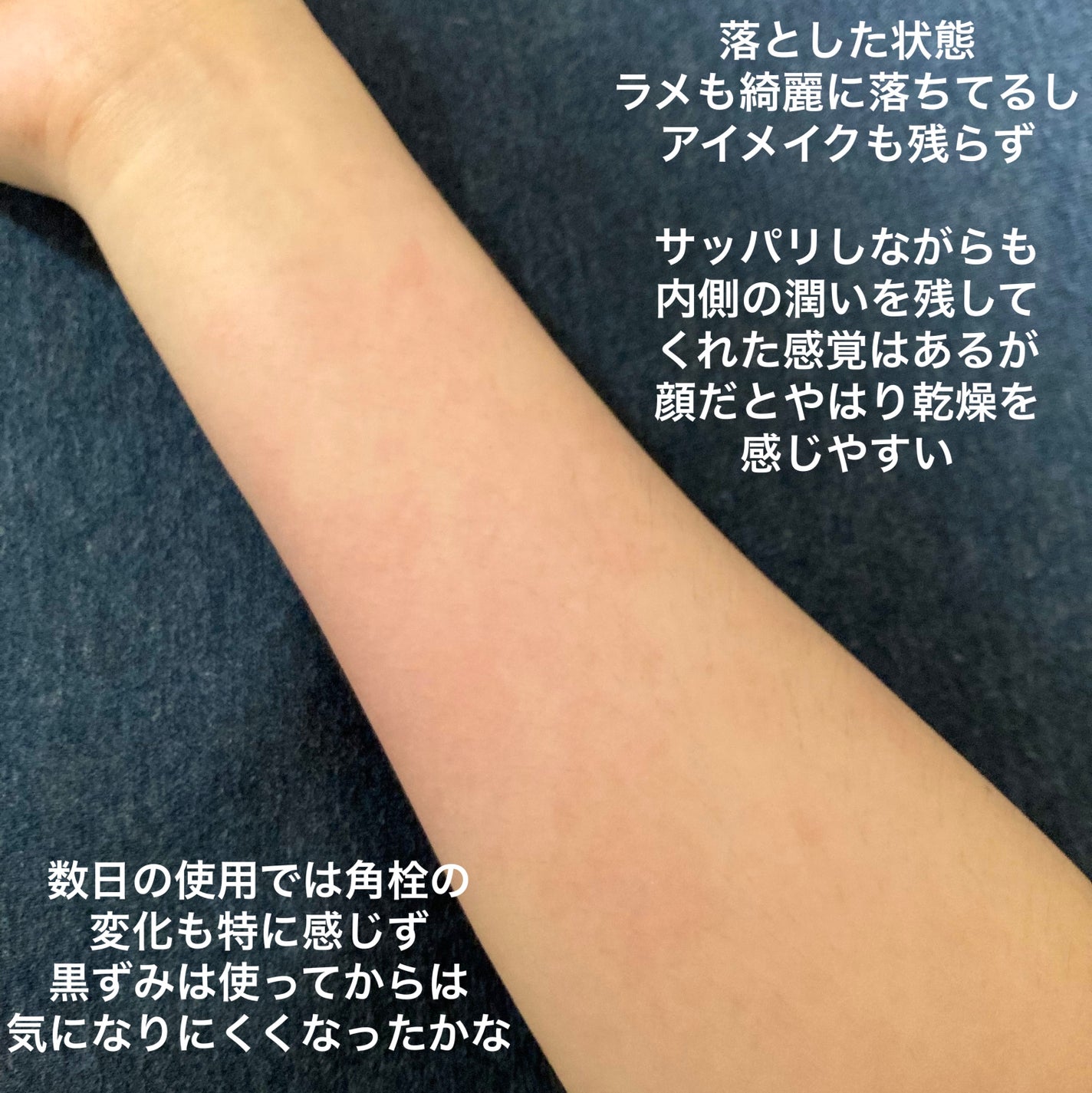 毛穴小町 酵素クレンジングオイル/ソフティモ/オイルクレンジングを使ったクチコミ(6枚目)