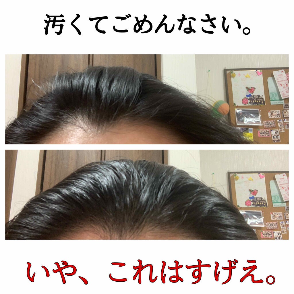 #髪ã®ãã¿ã€ããªã»ããã¹ãã¬ãŒ/ã«ã·ãŒããšã«/ãã¢ãã¹ãã䜿ã£ãã¯ãã³ãïŒ2æç®ïŒ