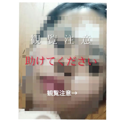 黯姫 on LIPS 「初投稿がこんな風になってしまって申し訳ないです泣黯姫です。写真..」(1枚目)