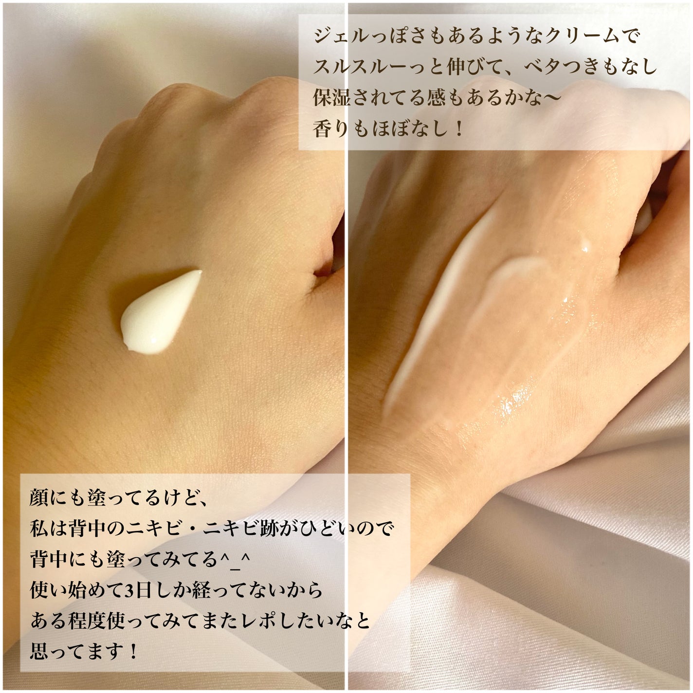 アキュリアルナインコントロールエックスクリーム/ACWELL/フェイスクリームを使ったクチコミ(3枚目)