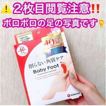 ⚠️2枚目、汚い脚の裏なので閲覧注意です💥👀
サンダルの季節は足のケア‼️👣
知らない方、一刻も早く試して欲しい‼️
本当に赤ちゃんの足みたいにふわふわになる💓

ベビーフット
イージーパックDP60分