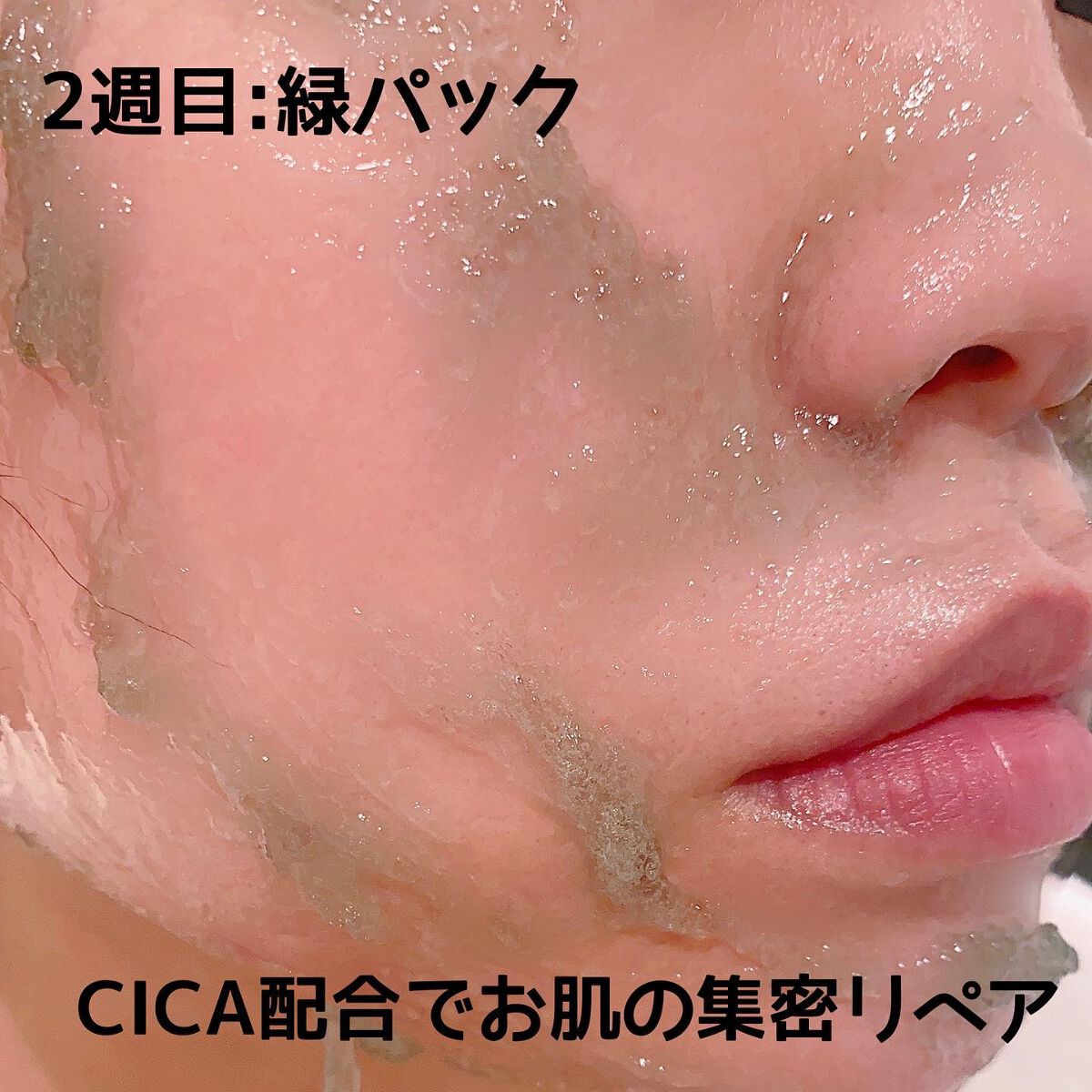 ニードル炭酸パック/NNE/洗い流すパック・マスクを使ったクチコミ(4枚目)