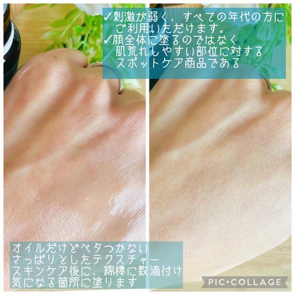 マジックティーツリーオイル/ブラン/フェイスオイルを使ったクチコミ(2枚目)