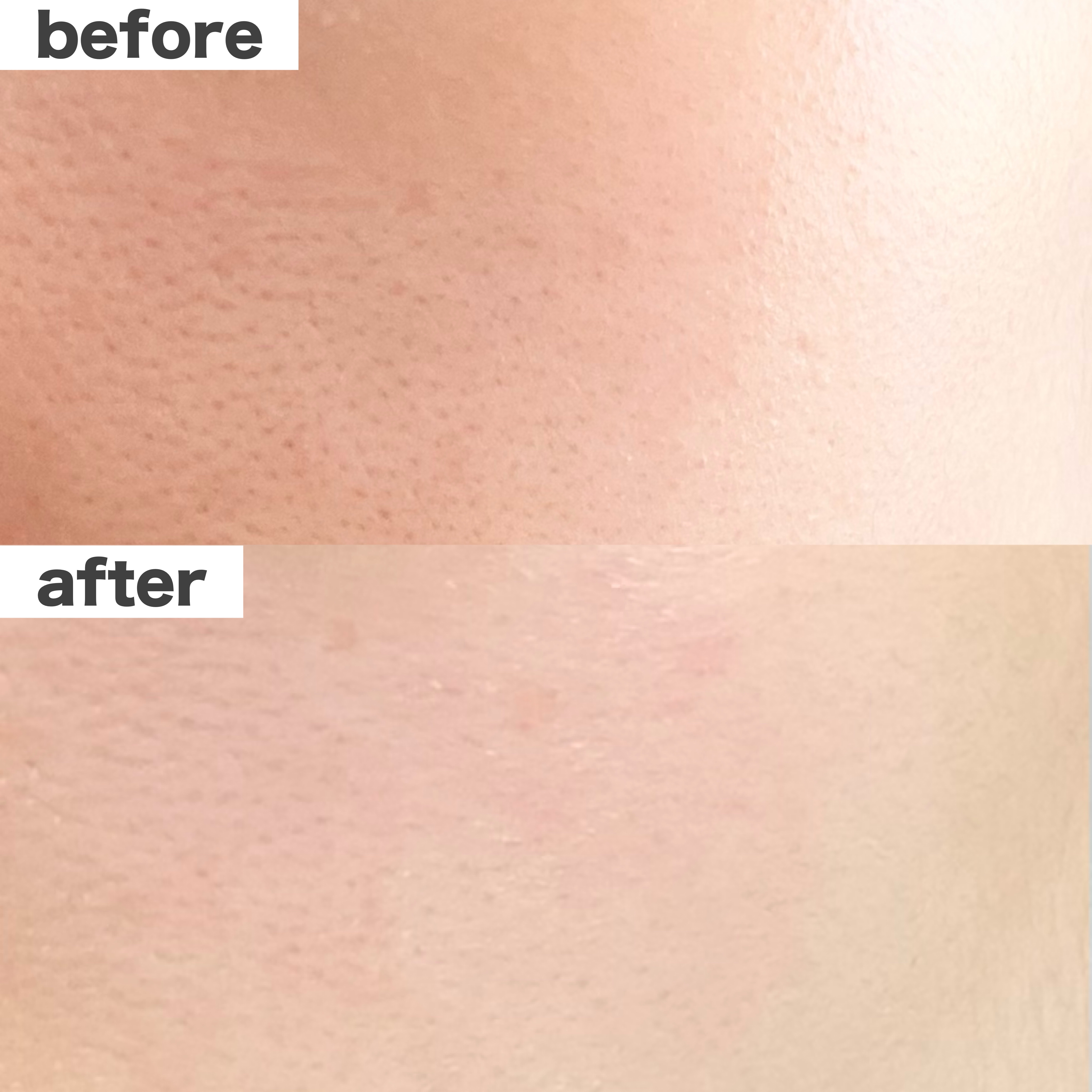 シカリニック HA バイオ エッセンス/CICALINIC/美容液を使ったクチコミ（3枚目）