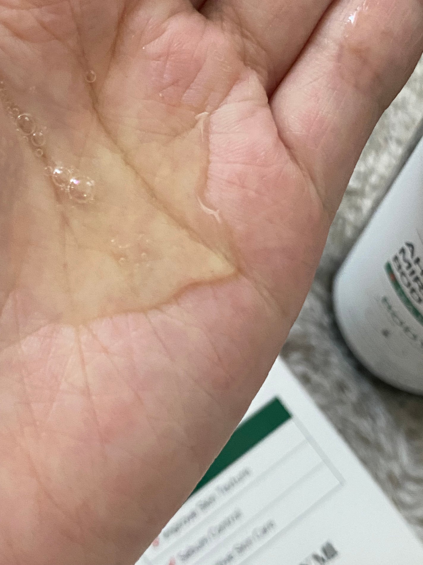 AHA·BHA·PHA 30デイズミラクルアクネボディクレンザー/SOME BY MI/ボディソープを使ったクチコミ(2枚目)