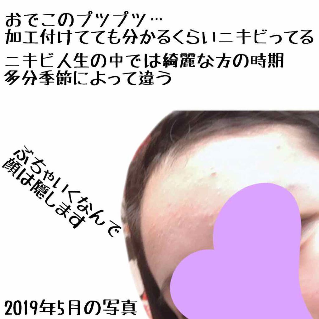 ホワイトアップ ローション(II)/アクアレーベル/化粧水を使ったクチコミ（2枚目）