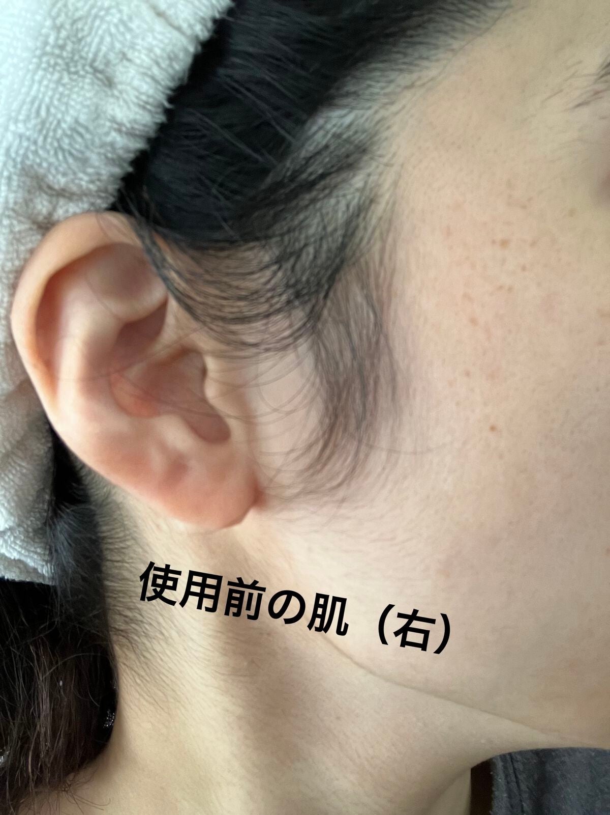 ブレミショット美容液/AMPLE:N/美容液を使ったクチコミ(9枚目)