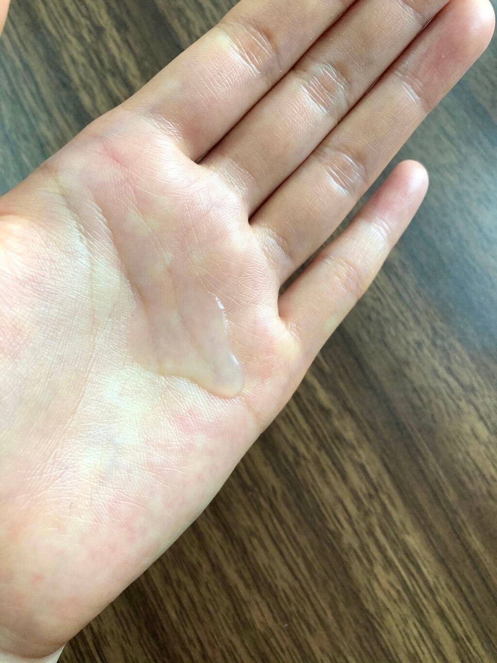 マデカソ CICAクリーム  /A’pieu/フェイスクリームを使ったクチコミ(5枚目)