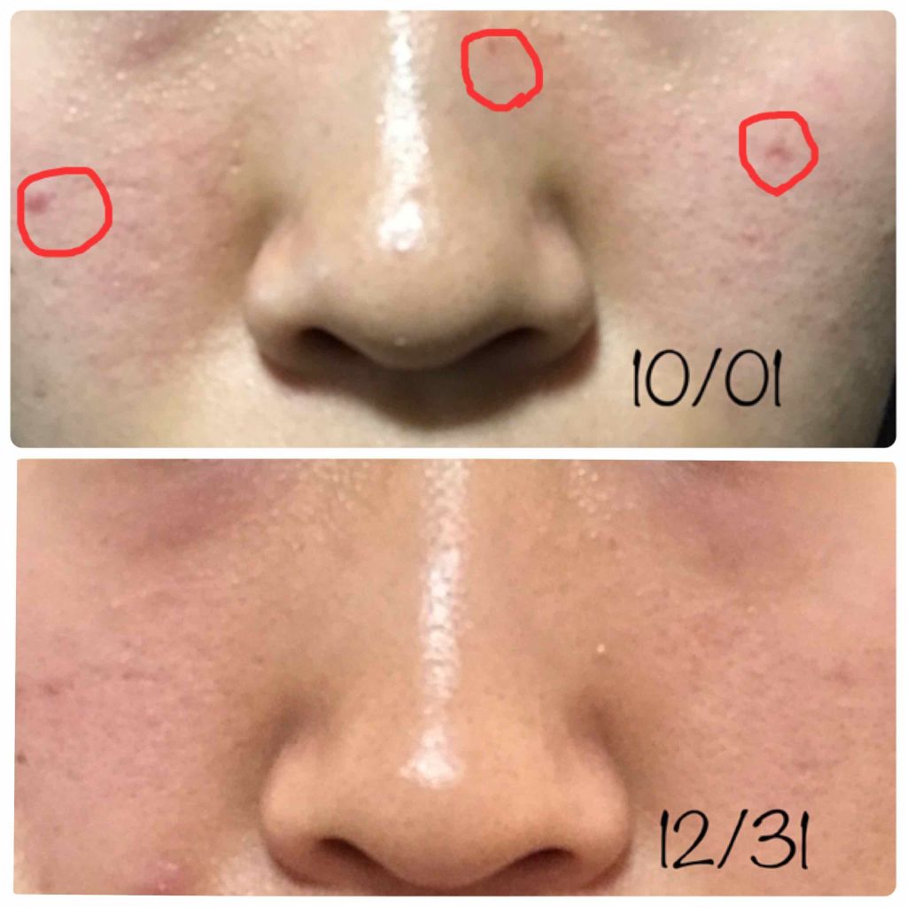 ウォッシャブル コールド クリーム/ちふれ/クレンジングクリームを使ったクチコミ(3枚目)