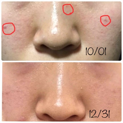 ウォッシャブル コールド クリーム/ちふれ/クレンジングクリームを使ったクチコミ(3枚目)