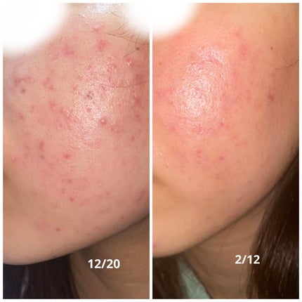 を使ったクチコミ(3枚目)