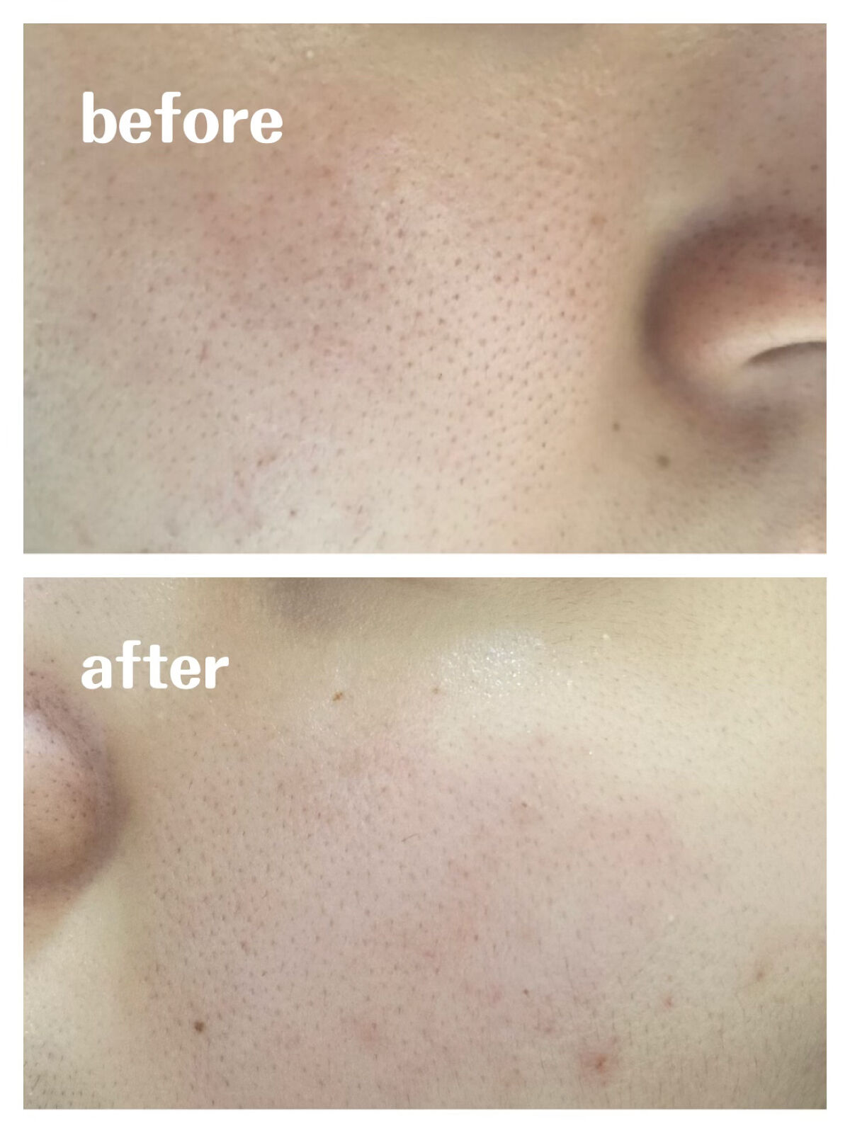 ティーツリーケアソリューション アンプルマスクJEX/MEDIHEAL/シートマスク・パックを使ったクチコミ（3枚目）